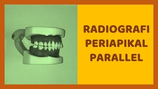 Teknik Radiografi Intraoral Periapikal Parallel Radiologi Dental [upl. by Nahsed]