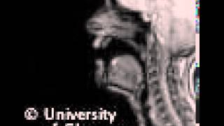 MRI voiced palatal lateralapproximant [upl. by Aennil581]