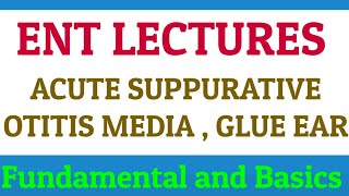 Acute Suppurative Otitis Media  ASOM  GLUE EAR  ENT LECTURES [upl. by Ennovaj]