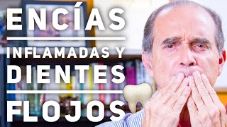 Episodio 1900 Encías Inflamadas Y Dientes Flojos [upl. by Davita]