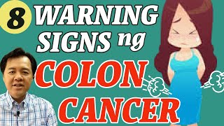 8 Warning Signs ng Colon Cancer  By Doc Willie Ong 1081 [upl. by Ibrab249]