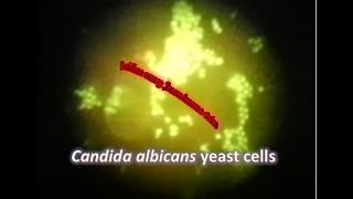 Candida albicans under Fluorescence microscope stained with Acridine Orange [upl. by Inafets]