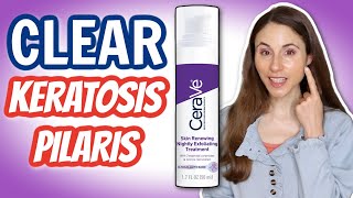 HOW TO CLEAR KERATOSIS PILARIS ON THE FACE DERMATOLOGIST DrDrayzday [upl. by Jaye]