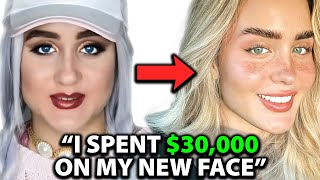 I was UGLY Before Spending 30000 on a NEW FACE  Surgeon Reacts [upl. by Enttirb]