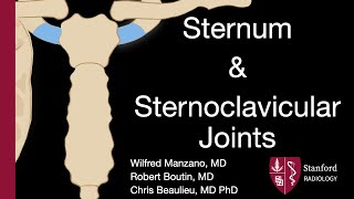 Sternum and Sternoclavicular Joints  Wilfred Manzano MD [upl. by Aitnahc]