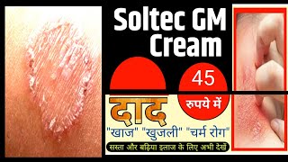 Ringworm Fungal Infection Treatment In Hindi Fungal Infection Cream Soltec GM cream दाद की दवा [upl. by Truelove]