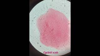 Scales Of Fish  Placoid Scale  Ctenoid Scale Cycloid Scale🐠🐋🐟 [upl. by Bobseine]