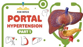 Portal Hypertension part 1 [upl. by Anohs]