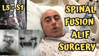 My Hospital Stay for L5S1 Spinal Fusion Surgery  ALIF [upl. by Anrahc]