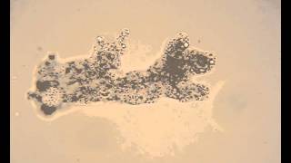 Live Amoeba proteus showing amoeboid movement [upl. by Inverson426]