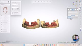 How To Align Models in 3Shape Dental Designer 2024 [upl. by Aikahc]