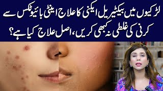 Bacterial Acne Treatment for Girls Top Tips and Tricks  Dr Sahar Chawla [upl. by Ozne]