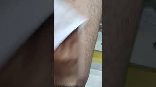 Wax skincare lipo work trending viral video viral speechviralvideos bodywax wax tips [upl. by Sudnor173]