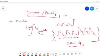 Types of PulsePulsus Paradoxus Pulsus Alternans Anacrotic Waterhammer pulse [upl. by Ahseuqal]