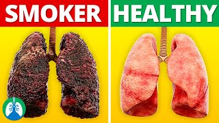 Smokers Lungs vs Healthy Lungs [upl. by Apps]