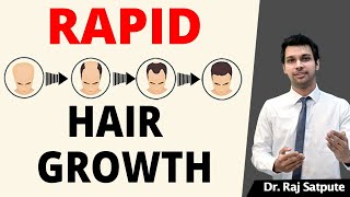 100 GUARANTED How To STOP HAIR LOSS NATURALLY amp REGROW HAIR FASTER Without MEDICINES  Men amp Women [upl. by Ajnat]