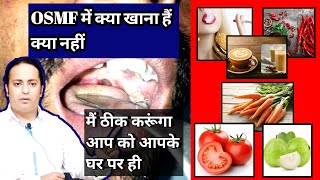 मैं ठीक करूंगा आप को आपके घर पर ही। OSMF treatment at home। submucous fibrosis treatment in India [upl. by Atiluj]