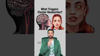 What triggers cluster headaches [upl. by Peppel]