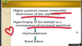 Hydronephrosis [upl. by Ellingston]