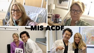 1 Year Recovery After ACDF Surgery  Start to Finish [upl. by Aicrag]