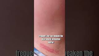 Watch This Before Using Hair Removal Creams ⚠️Dermatology Tips [upl. by Nylra]