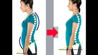 1 Full Routine to Fix Hunchback  Kyphosis amp Forward head carriage Type 2 ImpingementTendonitis [upl. by Orme]