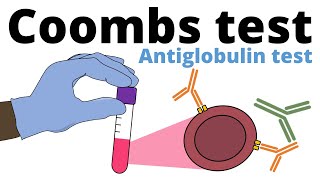 Coombs Test antiglobulin test [upl. by Tomasine]