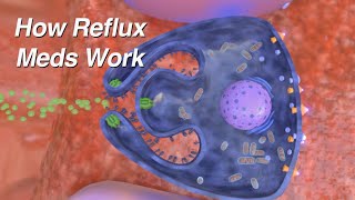 How do Reflux Medications Work Proton Pump Inhibitors H2 Blockers Alginates [upl. by Korrie]