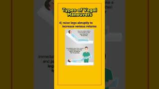 Vagal maneuvers the ultimate guideVagal maneuvers for SVT shorts [upl. by Yspyg194]