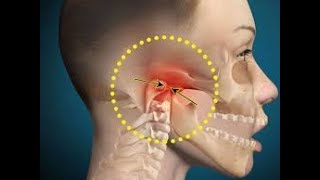 Part 2 Biomechanics of TMJ From normal physiology to disc Disorder [upl. by Noillimaxam]