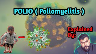 POLIO  Poliomyelitis  explained by Tariq Pathan [upl. by Par446]