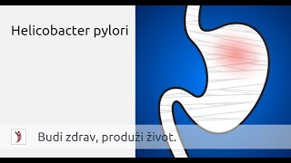 Helicobacter pylori • Heliko bakterija simptomi i lečenje [upl. by Airdnassac643]