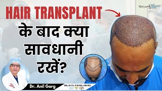 10 सावधानियां जो आपको जाननी चाहिए Hair Transplant के बाद  Care after Hair Transplant [upl. by Torrey232]