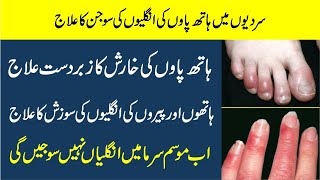 Hathon or paon ki ungliyon Ki Sojan Ka ilaj  Fingers swelling in winter  chilblain treatment urdu [upl. by Bettine955]