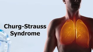 Churg Strauss Syndrome  Eosinophilic Granulomatosis With Polyangiitis Causes and treatment [upl. by Yancey]