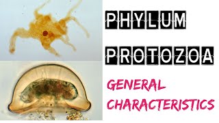 General Characteristics of Protozoa  Phylum Protozoa  TGT Biology  PGT Biology [upl. by Ahsinak]