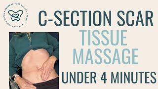 How To Manage Csection Scar Tissue [upl. by Beth632]