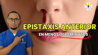 Epistaxis Anterior explicado fácilmente  ORL [upl. by Eizeerb]