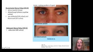 Introduction to Opthalmology [upl. by Yul]