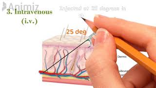 Injection techniques  Intramuscular im  Subcutaneous sc  Intravenous iv  Intradermal id [upl. by Moneta]