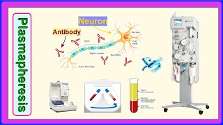 plasmapheresis [upl. by Anizor]