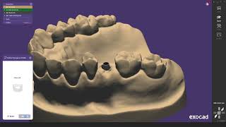 2024 exocad Guide Switching from OEM Scanbody to Medentika [upl. by Sisi]