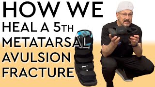 How We Heal a 5th Metatarsal Avulsion Fracture [upl. by Weiner]