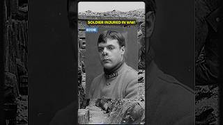 Soldier’s Injured Face Reconstructed After World War I 🤯 history ww2 war military [upl. by Idihsar]