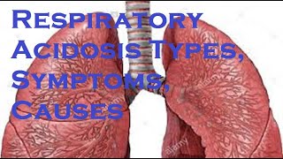 Respiratory Acidosis Types Symptoms Causes [upl. by Cristoforo]