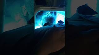 Pdt light therapy skinrejuvenation draqeel skincare beauty lighttherapy skin [upl. by Adnorat403]