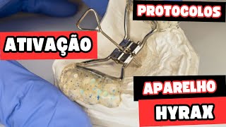 Como deve ser feita a ativação do aparelho Hyrax e o que esse aparelho gera na maxila Aula 165 [upl. by Lynde584]