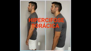 EXERCÍCIOS PARA HIPERCIFOSE TORÁCICA [upl. by Mikeb248]