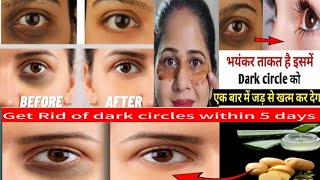 eyes dark circle remove tips  under eye dark circles Dark circles treatment Dr Muzammil Ehsan [upl. by Ahsed]