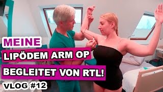 LIPÖDEM ARM OP I Begleitet von RTL I Myra Snöflinga VLOG12 [upl. by Chitkara394]